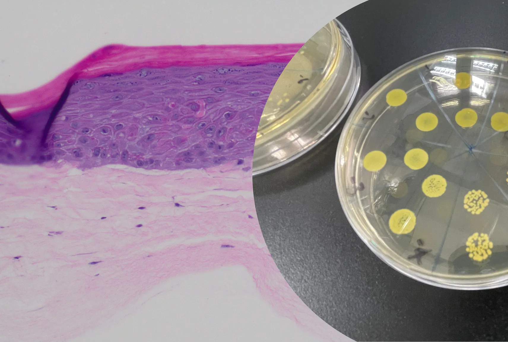 Uncovering the Secrets of the Skin Microbiome